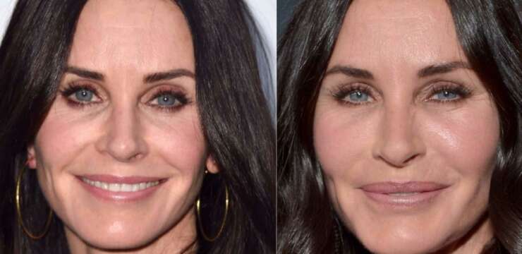 courteney cox chirurgie sthetique