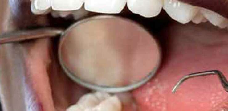 implant dentaire tunisie