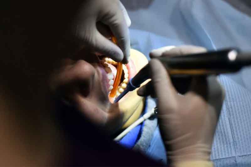 prothèse dentaire en tunisie