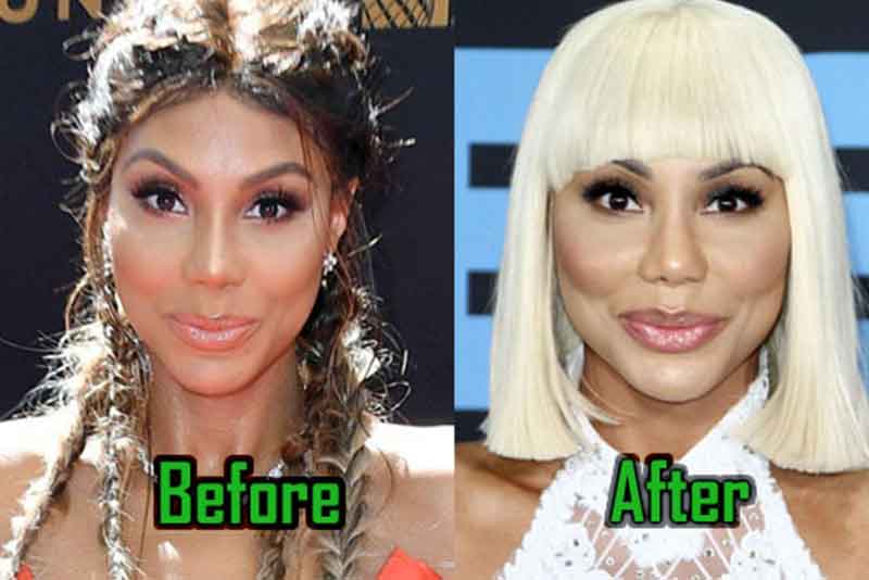 tamar braxton before after