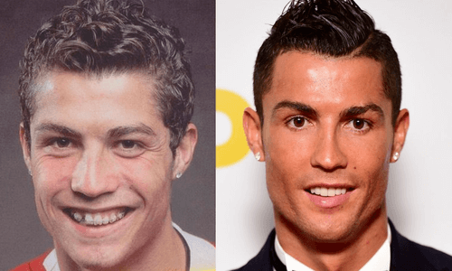 Cristiano Ronaldo avant et après