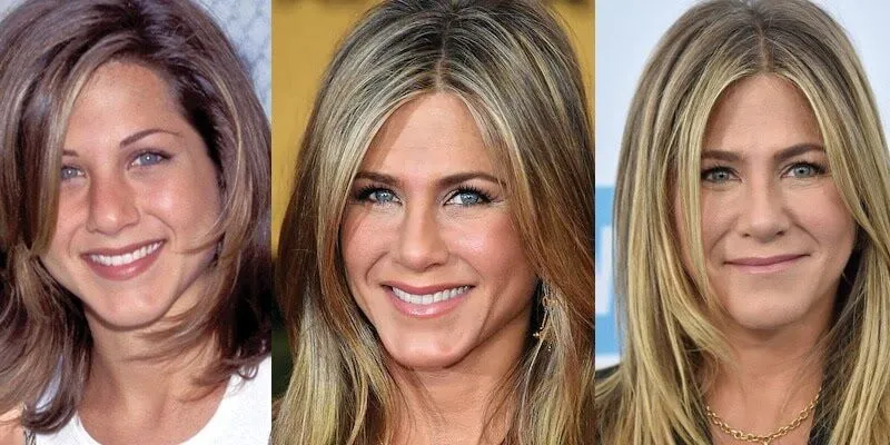 Photos de Jennifer Aniston Avant/après la chirurgie esthétique