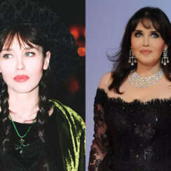 Isabelle Adjani : Chirurgie esthétique