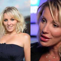 Les secrets de Myriam Abel révélés : Comment la chirurgie esthétique a transformé son physique