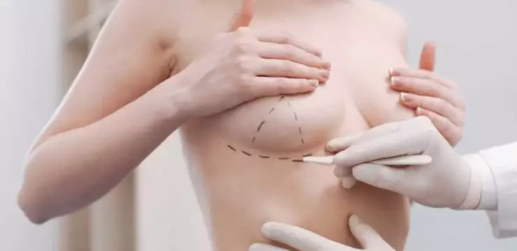 Lifting des seins ou prothèses