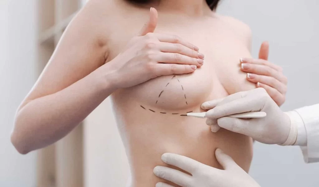 Lifting des seins ou prothèses